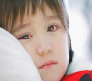 小儿红眼病预防
